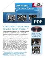 Ucoceles: of The Paranasal Sinuses