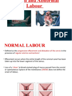 Normal Abnormal Labour