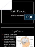 Brain Cancer: by Cara Klingaman