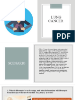 Lung Cancer