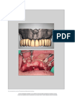 Scalloped Guide IJPRD