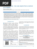 Kawasaki Disease Two Case Reports From A Rural Set Up in Gujarat