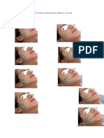 Aplicación de Láser para Parálisis de Nervio Facial