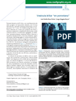 Vésicula en Porcelana-Desbloqueado