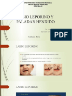 Labio Leporino