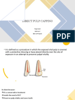 Direct Pulp Capping