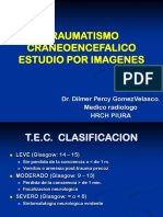 Trauma Craneo Encefalico Ucv PDF