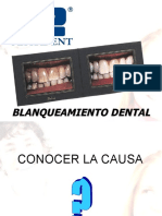 Blanqueamiento Dental