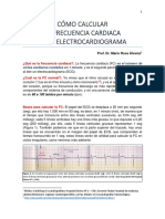 Como Calcular Frecuencia Cardiaca en ECG