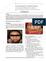 Adenoid Faces Management