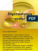 Hipermetropia Ocular