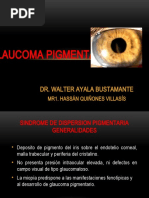 4.1 Glaucoma Pigmentario