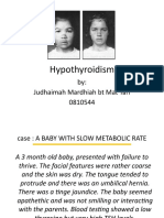 Hypothyroidism: By: Judhaimah Mardhiah BT Mat Tari 0810544