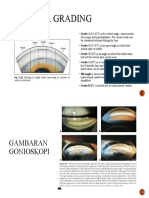 Gambaran Gonioskopi + Shaffer Grading