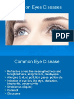 Common Eye Diseases