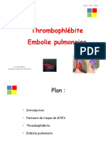 Thrombophlébite Et Embolie Pulmonaire