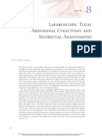 Laparoscopic Total Abdominal Colectomy and Ileorectal Anastomosis