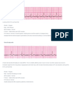 ECG Abnormalities