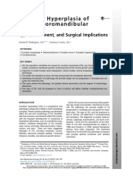 Condylar Hyperplasia of The Temporomandibular Joint: Types, Treatment, and Surgical Implications