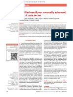 Modified Semilunar Coronally Advanced Flap: A Case Series