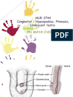 NUR 2744 Congenital: Hypospadias, Phimasis, Undescent Testis