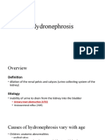 Hydronephrosis