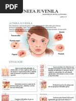Acneea Juvenila