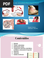 Sã Ndrome de Ovario Poliquã Stico 2022