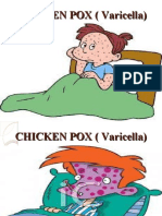 Chicken Pox (Varicella) 2