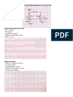 Electrocardiogramas Patológicos