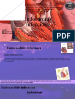 Endocarditis Infecciosa Miranda