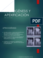 Apexogénesis y Apexificación