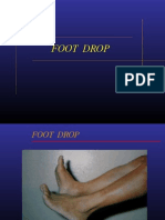 Foot Drop