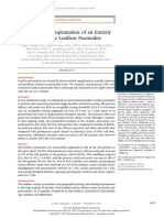 Percutaneous Implantation of An Entirely Intracardiac Leadless Pacemaker