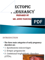 Ectopic Pregnancy