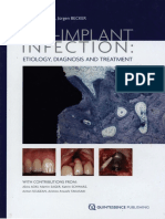 En Periimplantita