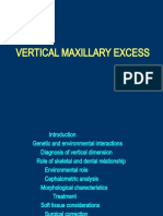 Vertical Maxillary Excess