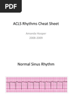 ACLS Rhythms Cheat Sheet