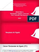 Neoplasia Higado y Pancreas