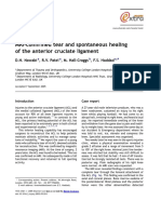 MRI-confirmed Tear and Spontaneous Healing of The Anterior Cruciate Ligament