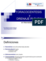 TORACOCENTESIS