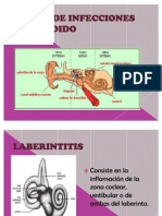 Tipos de Infecciones en El Oido Nohemi