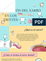 Formación Del Sarro en Los Dientes