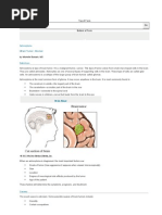 Astrocytoma