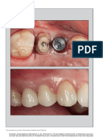 The International Journal of Periodontics & Restorative Dentistry