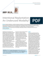 Intentional Replantation - An Underused Modality?