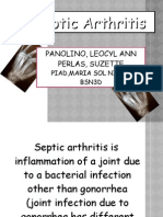 Septic Arthritis