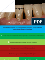 Periodontitis Agresiva