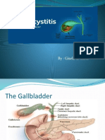 Chole Cystitis