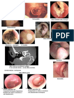 Patologia Ouvido